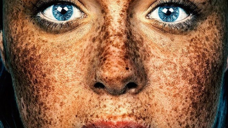 Unique Beauty Of Freckled