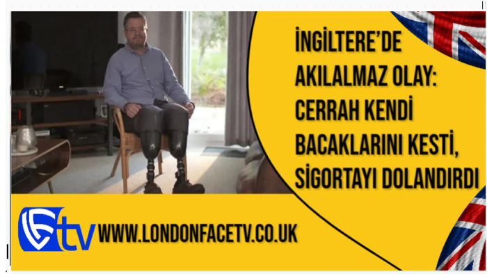 İngiltere’de Akılalmaz Olay: Cerrah Kendi Bacaklarını Kesti, Sigortayı Dolandırdı
